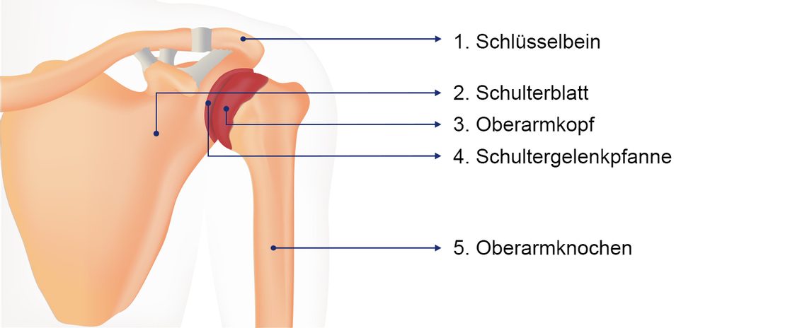 Schulterarthrose Gelenk