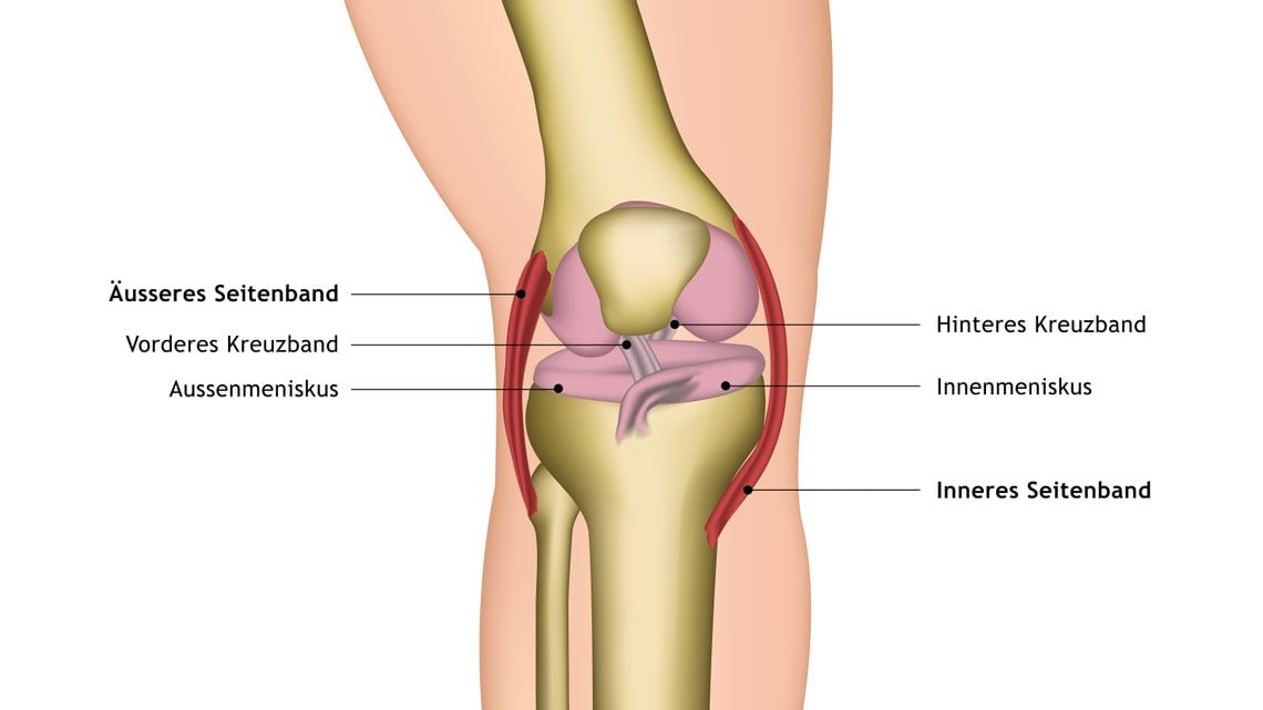 Bänderdehnung im Knie