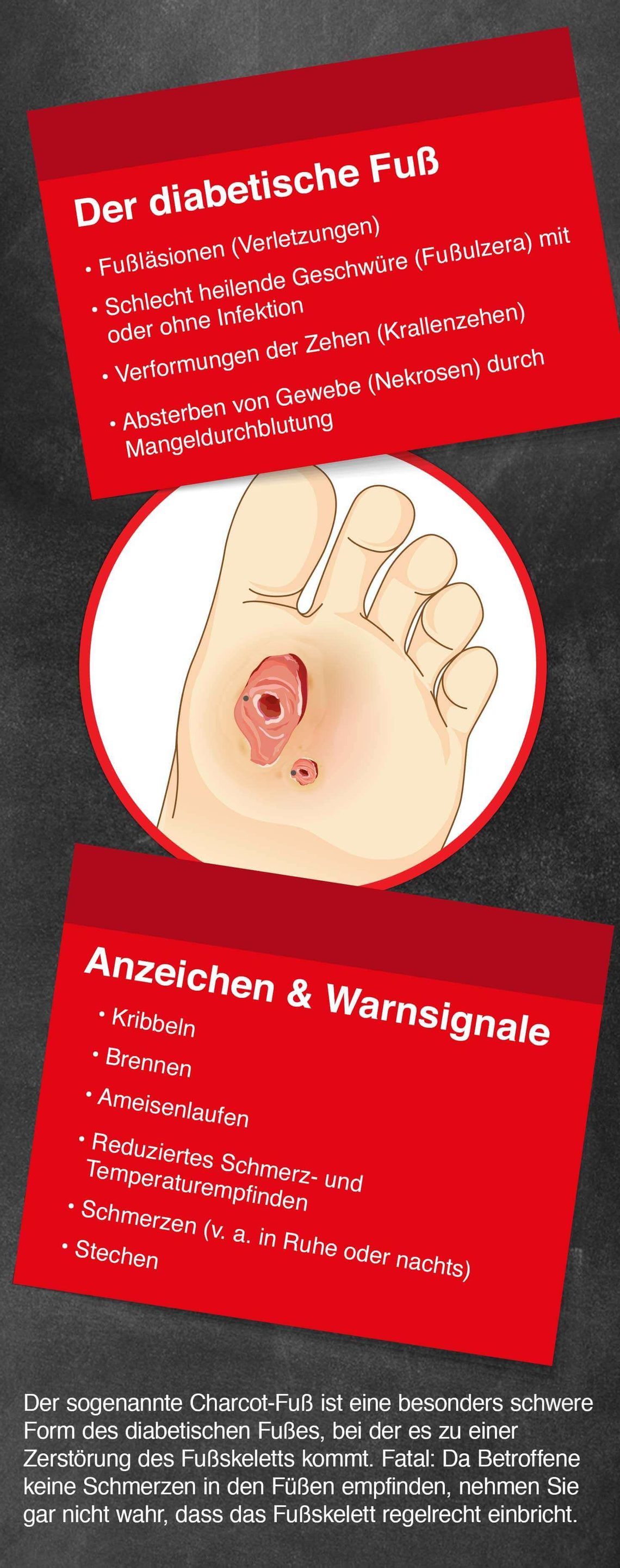 Diabetischer Fuss: Anzeichen &amp;amp; Warnsignale