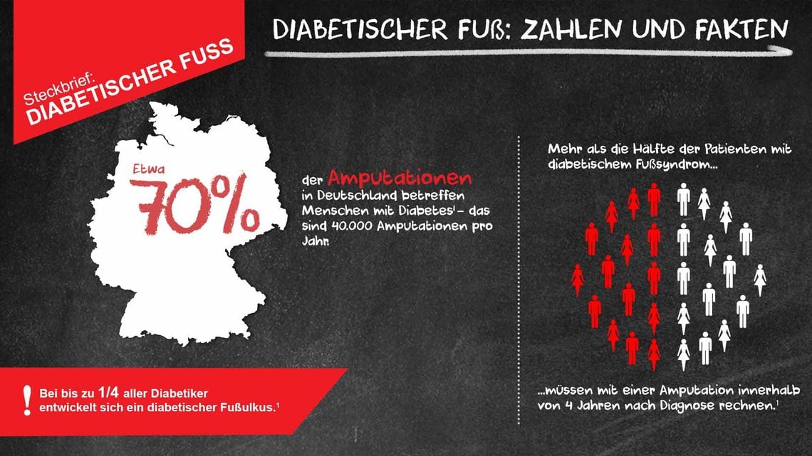 Diabetischer Fuss: Daten & Fakten