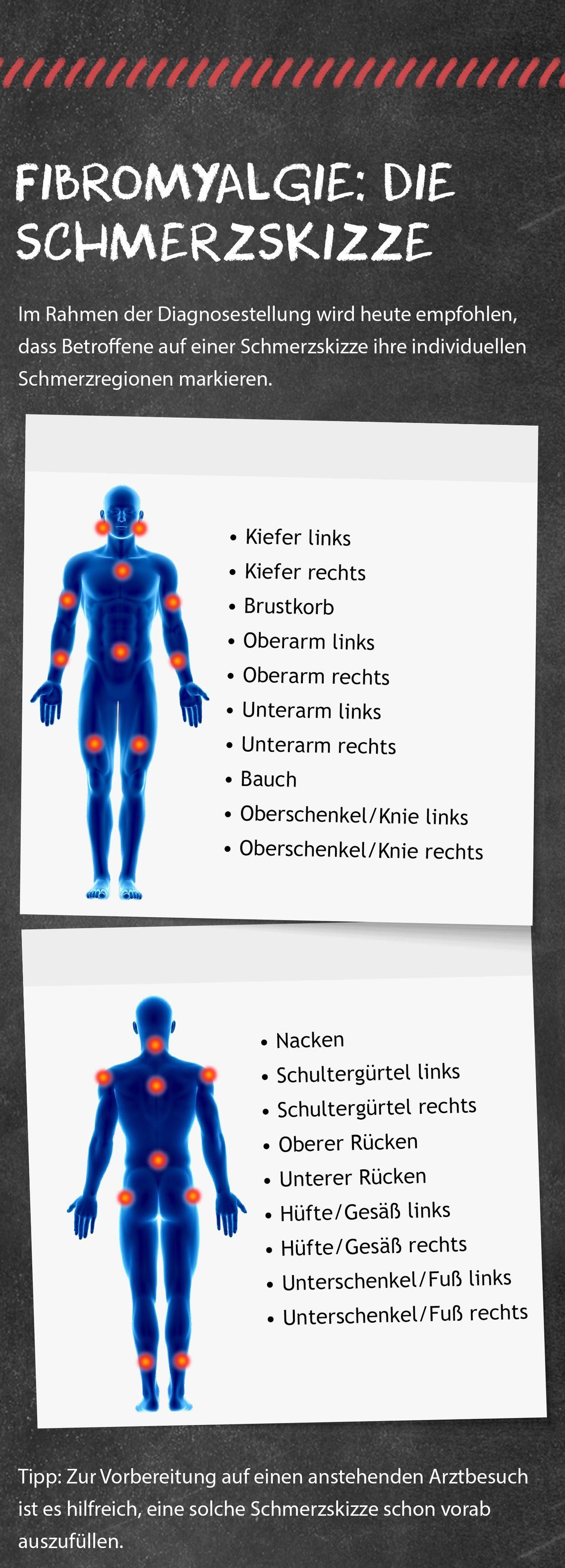Fibromyalgie: Steckbrief
