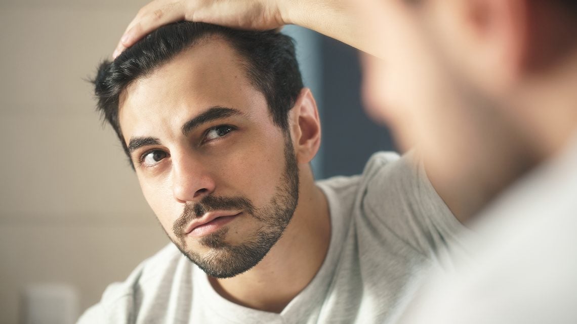 Haarausfall bei Männern: <br />Ursachen und Formen