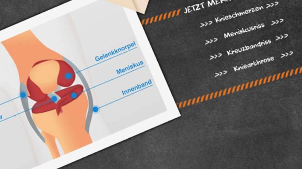 Steckbrief: Knieschmerzen