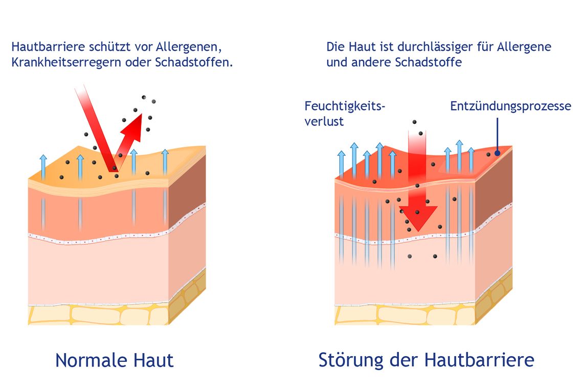 Hautvergleichsgrafik