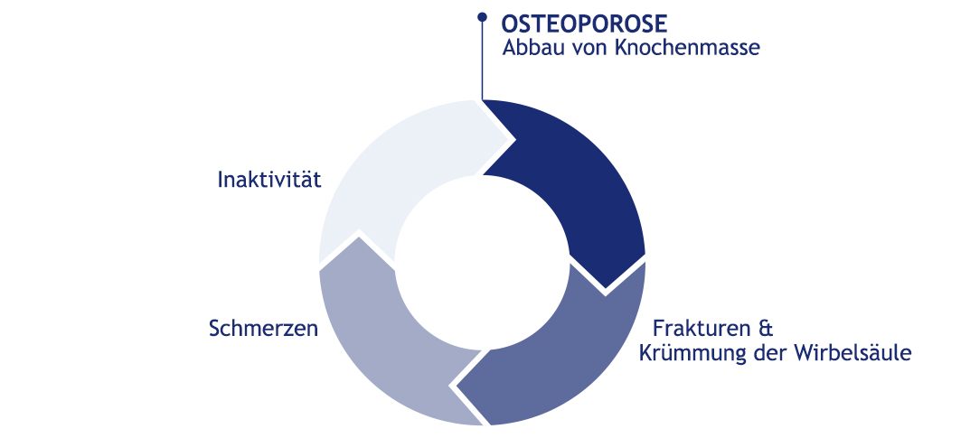 Osteoporose – Kreisverlauf