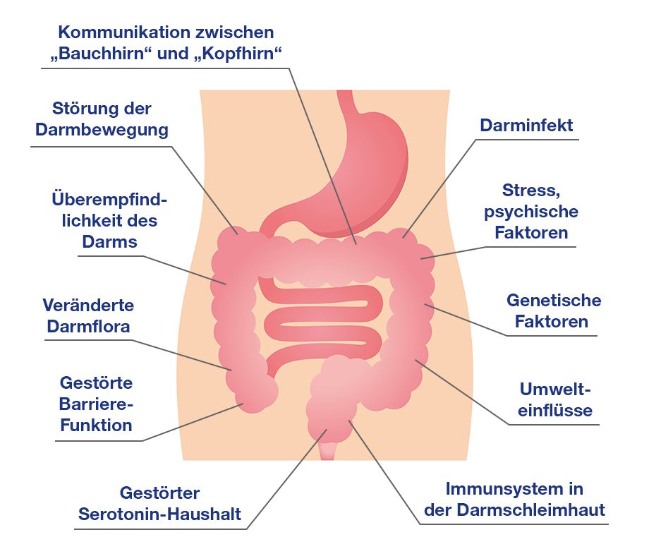 Reizdarmsyndrom: Ursachen