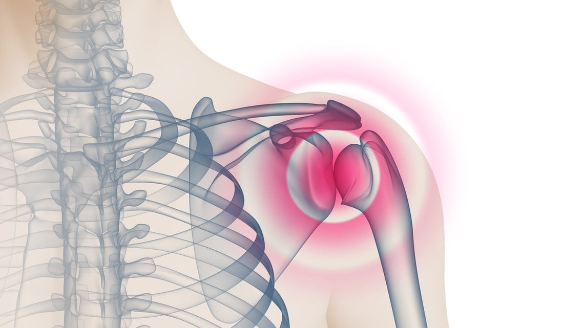 Schulterschmerzen: Ursachen